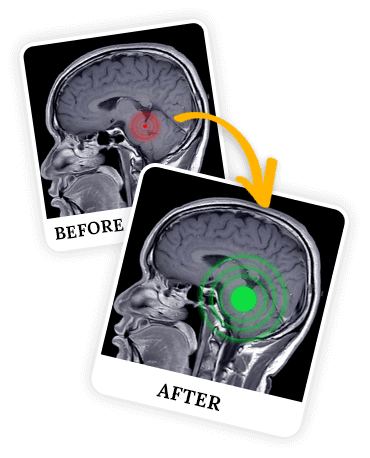 How Supermind Signal Works - Science Behind it